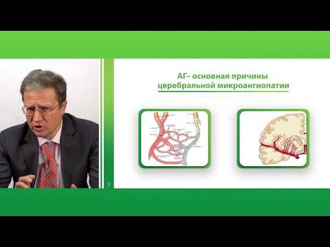 Видео: Пациент с хронической ишемией головного мозга на амбулаторном приеме. Профессор В.В.Захаров