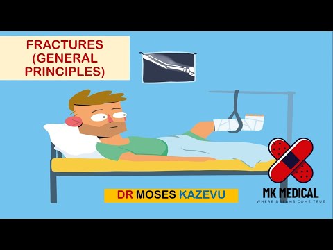 Видео: Переломы (общие принципы)