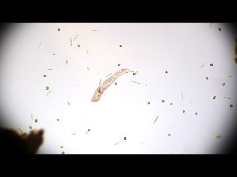 Видео: ЧТО НАХОДИТСЯ В КАПЛЕ ВОДЫ С ЧИСТОГО И ГРЯЗНОГО КОЛОДЦА ПОД МИКРОСКОПОМ