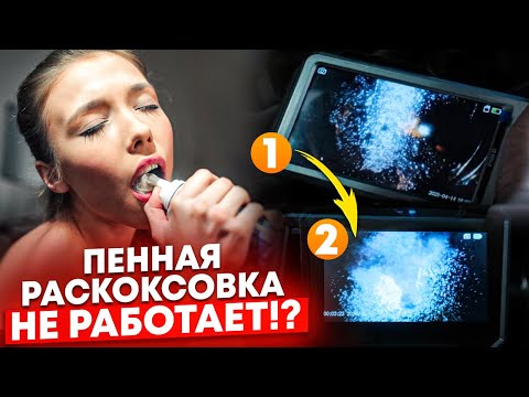 Видео: Быстрая пенная раскоксовка LAVR Complex через месяц