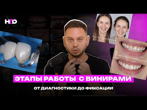 Видео: Виниры. Этапы работы | PROвиниры Прокопович Виктор