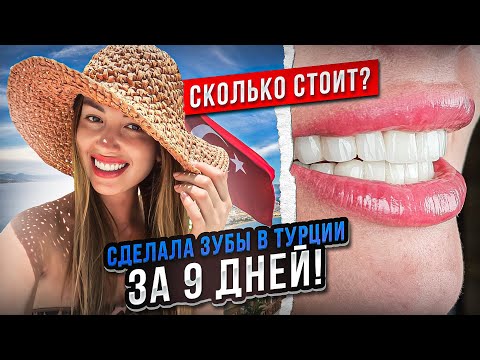 Видео: СДЕЛАЛА ЗУБЫ В ТУРЦИИ ЗА 9 ДНЕЙ/ СКОЛЬКО СТОЯТ ВИНИРЫ?