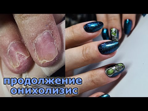 Видео: ❤ ФРЕЗЫ для мастера маникюра ❤ ОНИХОЛИЗИС ❤ РЕМОНТ ногтей ❤ СЛОЖНАЯ РАБОТА ❤