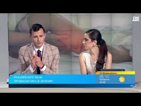 Видео: Съдов хирург каза как да се справим с разширените вени