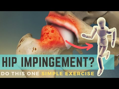 Видео: Одно высокоэффективное упражнение на импинджмент тазобедренного сустава (фемороацетабулярный импи...