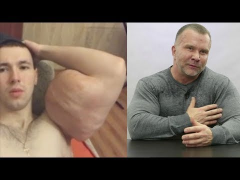 Видео: Что стало с синтольщиком! Доктор Любер