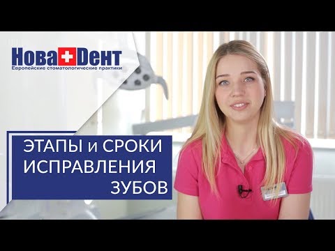Видео: Кривые зубы исправление. 🌸 100% способы исправления кривых зубов и создание идеальной улыбки. 12+