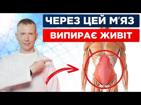 Видео: Випираючий живіт, нетримання сечі, гіперлордоз, біль у попереку, діастаз і все через ЦЕЙ м'яз