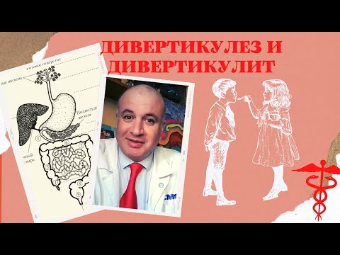 Видео: Дивертикулез и Дивертикулит: Симптомы, лечение и профилактика