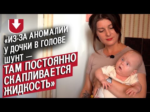 Видео: У моей дочери спина Бифида: Вероника | Быть мамой