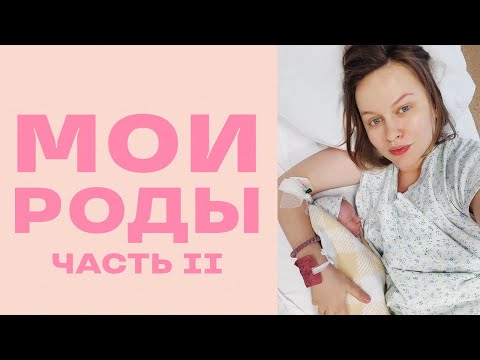 Видео: МОИ РОДЫ 2 ЧАСТЬ + КАДРЫ ИЗ РОДДОМА: амниотомия, эпидуральная анестезия, схватки, рождение малыша