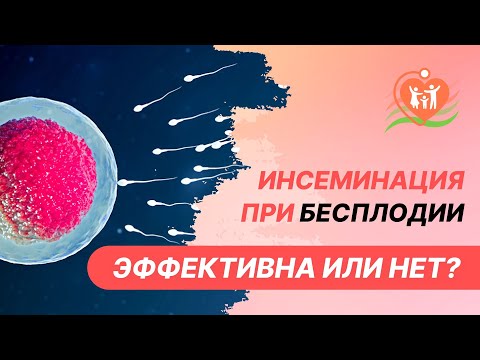 Видео: 🧪 Инсеминация при бесплодии - эффективна или нет?