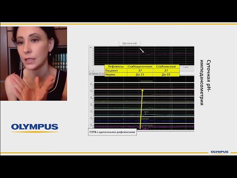 Видео: Кайбышева В.О. Клинический случай: пищевод Баррета?