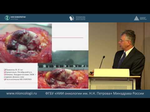 Видео: Принципы ранней диагностики меланомы. Роль дерматоскопии.