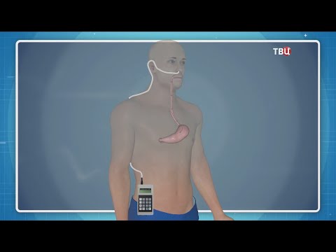 Видео: Валитова Э.Р. pH-импеданс желудка. Доктор И...