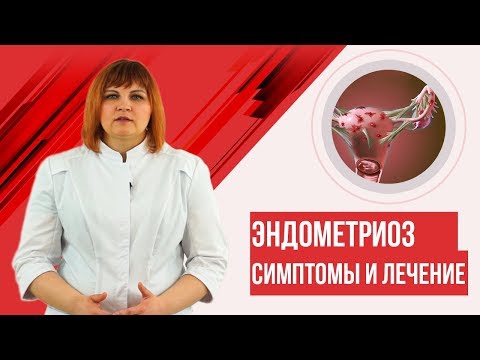 Видео: Эндометриоз. Симптомы, лечение. ✓3D