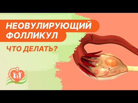 Видео: 👩‍⚕️​ Неовулирующий фолликул / Персистенция фолликула - что делать?