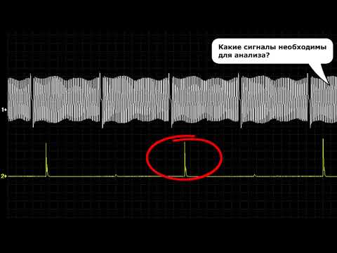 Видео: CSS-тест USB Autoscope IV. Лекция Андрея Шульгина, часть 1.