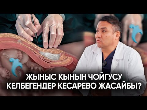 Видео: Кесареводон кийин бул белгилер байкалса дароо дарыгерге баруу керек| Арсен Аскеров| Алдей