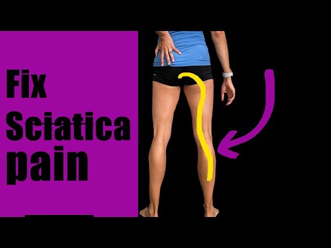 Видео: У вас ишиас или синдром грушевидной мышцы? И как это исправить!
