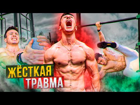 Видео: НЕ УЧИ Эти Элементы! 3 ДИКИХ Элемента (ЖЁСТКАЯ Травма)