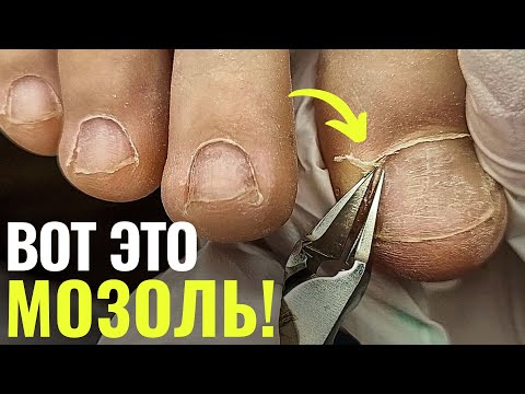 Видео: УСТАЛА МУЧАТЬСЯ!😫ПОДРОБНО про ПЕДИКЮР для новичков!