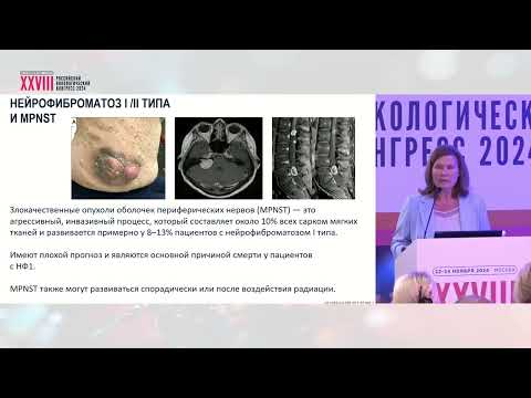 Видео: Шваннома