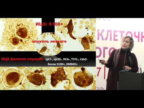 Видео: Стандартизация обработки и приготовления гистологического и цитологического материала