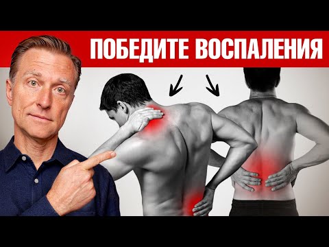 Видео: 10 причин воспаления в организме. 11 способов восстановления. ✅
