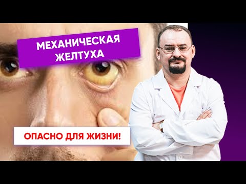 Видео: Механическая желтуха - объяснение этого состояния от доктора Голода.