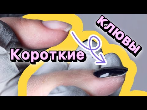 Видео: Поднятие клюющих ногтей. Короткие клюющие ногти.