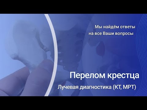 Видео: Перелом крестца