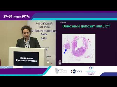 Видео: Показания к неоадъювантной терапии N+ рака прямой кишки в 2019 году. С.С. Балясникова