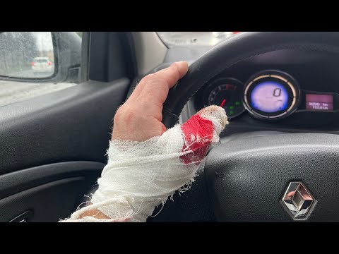 Видео: ПОПАЛ В БОЛЬНИЦУ! СЕРЬЕЗНАЯ ТРАВМА ПРИ РАЗБОРЕ ТЕХНИКИ!