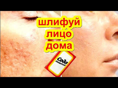 Видео: ПРОСТАЯ СОДА ОМОЛОДИТ ЛИЦО на 10 Лет ! Маска для Лица от Морщин Домашний Рецепт Шлифовка Кожи
