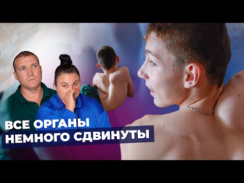 Видео: БОЛЕЗНЬ ПЕЛЬЦЕУСА-МЕРБАХЕРА | История Алексея Сергеева