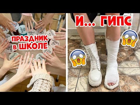 Видео: СЛОМАЛА НОГУ под Новый Год... ТРЕШ девАчки 😱