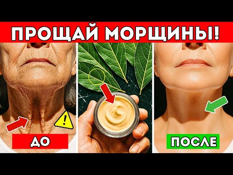 Видео: Лавровый Лист В 1 000 000 Раз Сильнее Ботокса – Удаляет Все Морщины Даже В 70 Лет Здоровье Пожилых