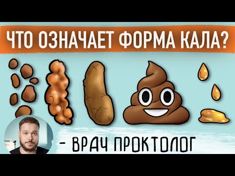 Видео: О ЧЕМ ГОВОРИТ ФОРМА СТУЛА. Бристольская шкала кала.