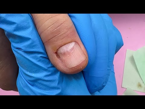 Видео: Чистим ноготь #nails #nailtutorial #nailart #nailtech #ногти
