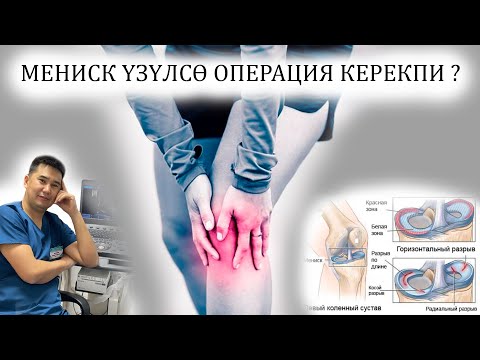 Видео: Мениск үзүлсө эмне кылуу керек? Ортопед-травматолог Нурбек Рыскулов