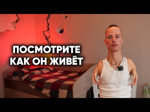 Видео: ВЫ МОИ РУКИ НЕ НАХОДИЛИ? Удивительная жизнь парня из Сибири