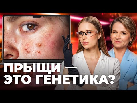 Видео: Причины акне, о которых не говорят. Что поможет убрать высыпания?