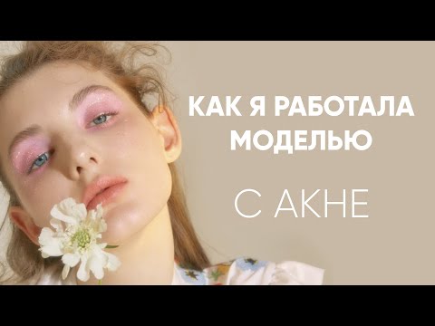 Видео: Как я работала моделью с акне? | Про модельные контракты, комплексы, кастинги, съёмки, реакцию людей