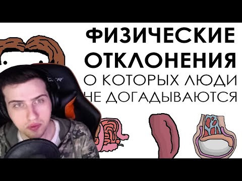 Видео: Hellyeahplay смотрит: Физические отклонения о которых люди не догадываются - Академия Сэма Онеллы