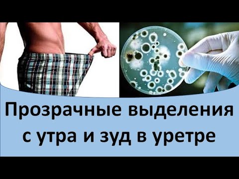 Видео: Прозрачная капля с утра и зуд в уретре
