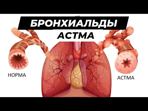 Видео: Бронхиальды астма / Этиология / Патогенез / Фенотиптер / Аспириндік астма