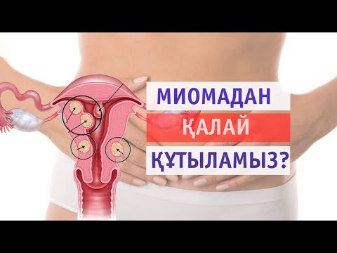 Видео: Миоманың емі/ Миоманы қалай емдеу керек?