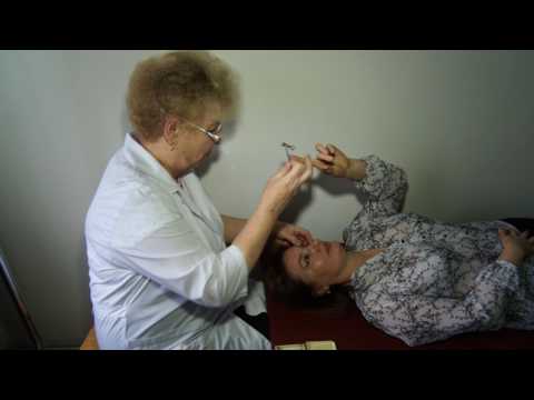 Видео: Как избежать глаукомы.