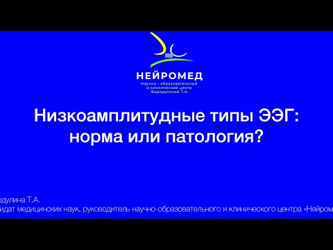 Видео: Низко амплитудный тип ЭЭГ: норма или патология?